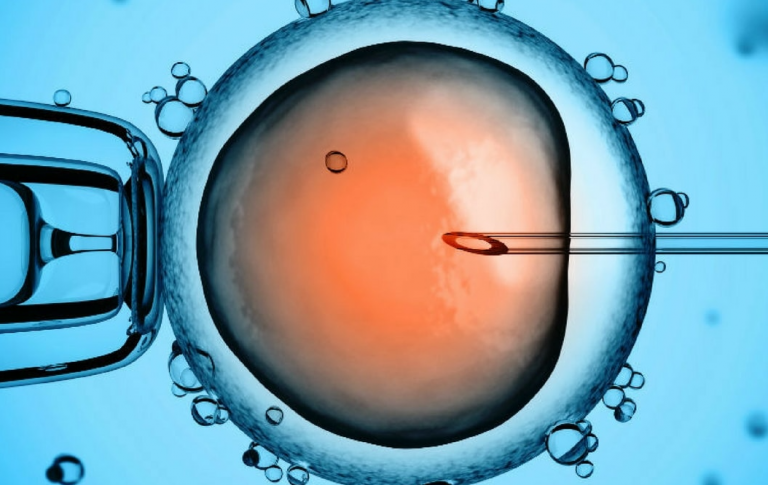 Ankara Tüp Bebek Tedavisi Nedir? Ankara Tüp Bebek Tedavisi Nedir?